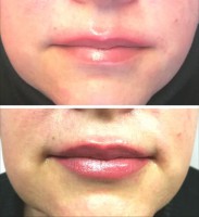 /album/fotogalerie/rty-pm-jpg/